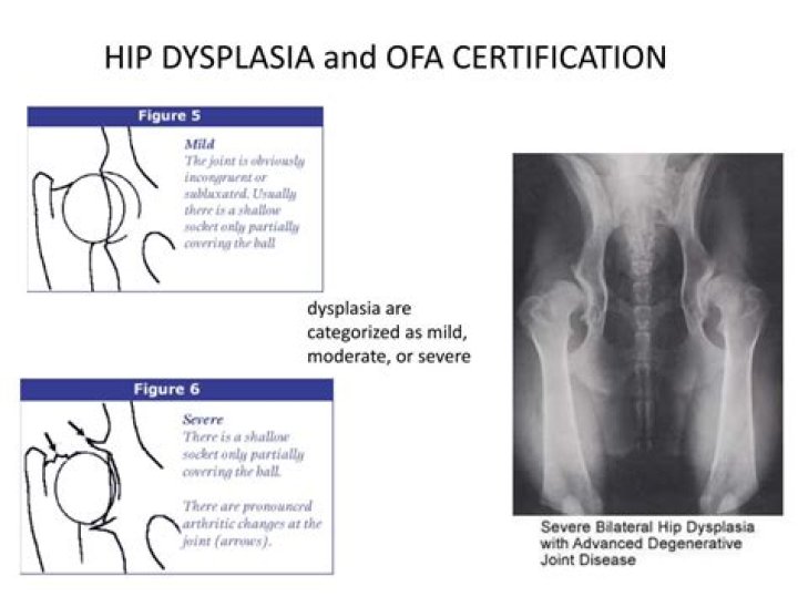 Are Ergobaby hip dysplasia certified?
