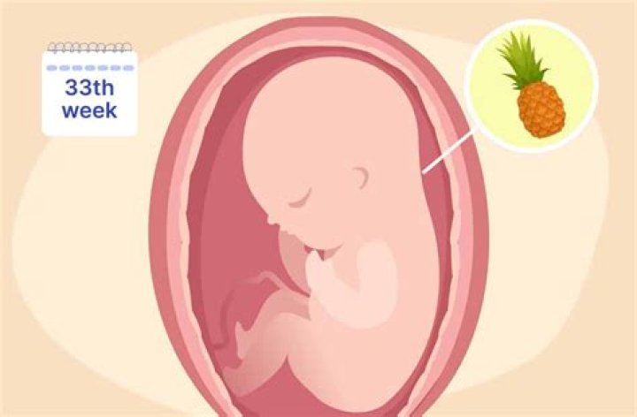 Can a 33 week baby survive?