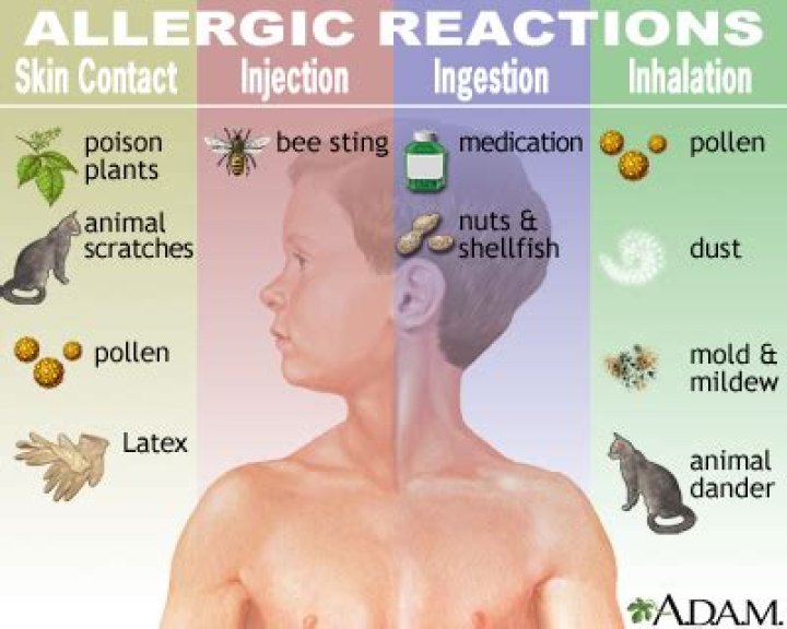 Can a person be allergic to insulin?