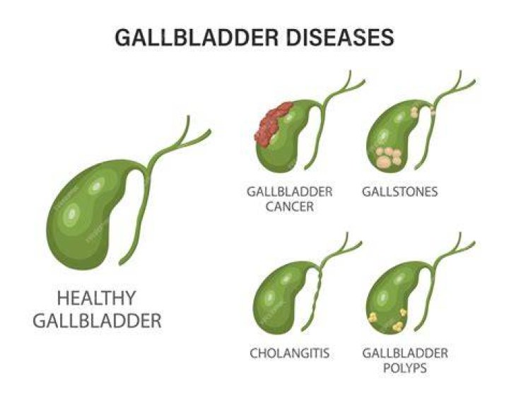 Can gallbladder cause breathing problems?