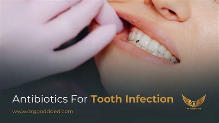 Can GP prescribe antibiotics for tooth infection?