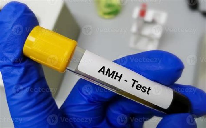 Can I eat before AMH blood test?