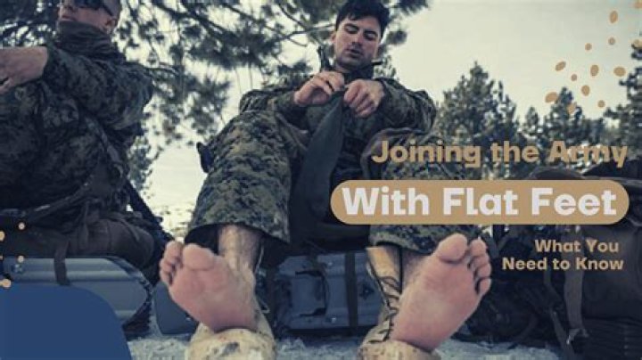 Can I join military with flat feet?