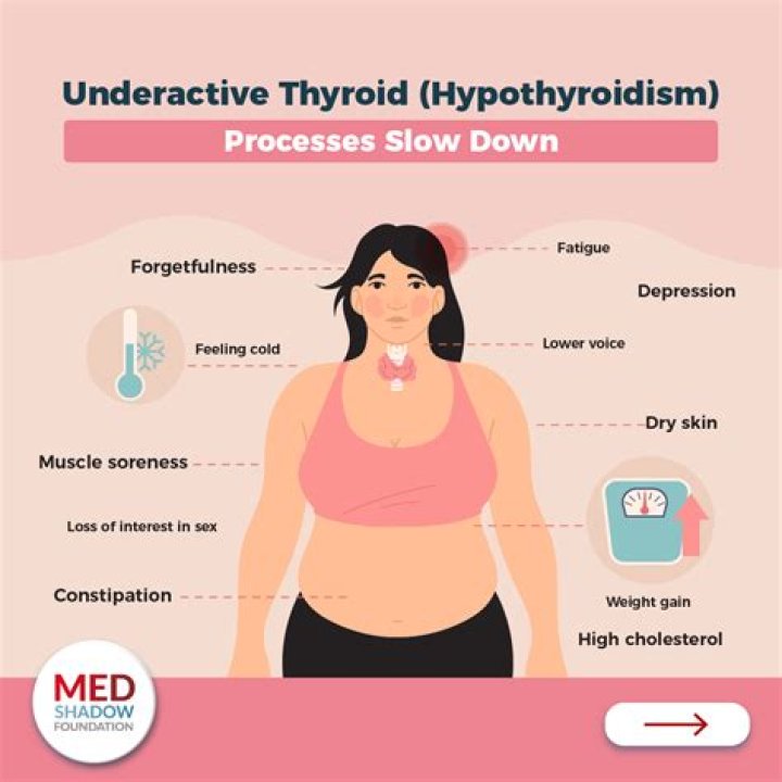 Can you develop hypothyroidism in your 20s?