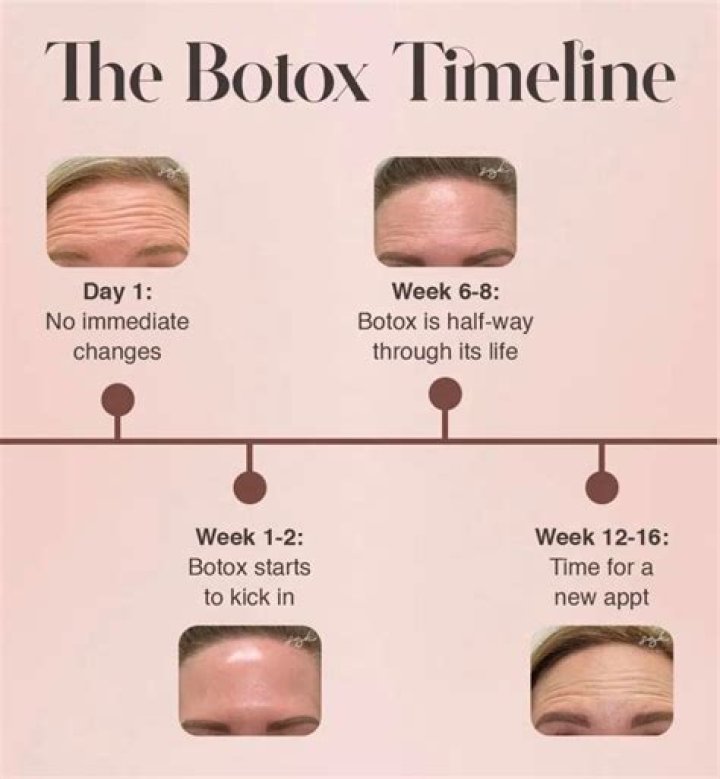 Can you feel Botox wearing off?
