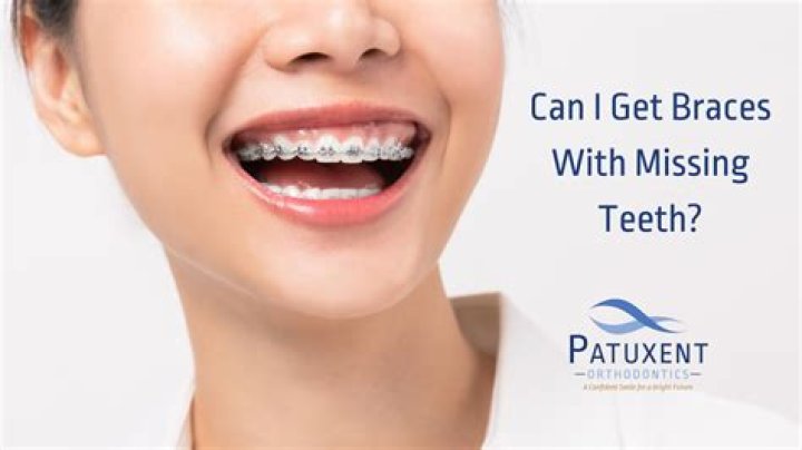 Can you get braces on a fake tooth?