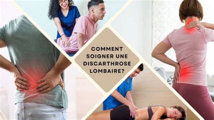 Comment soulager une Discarthrose lombaire ?