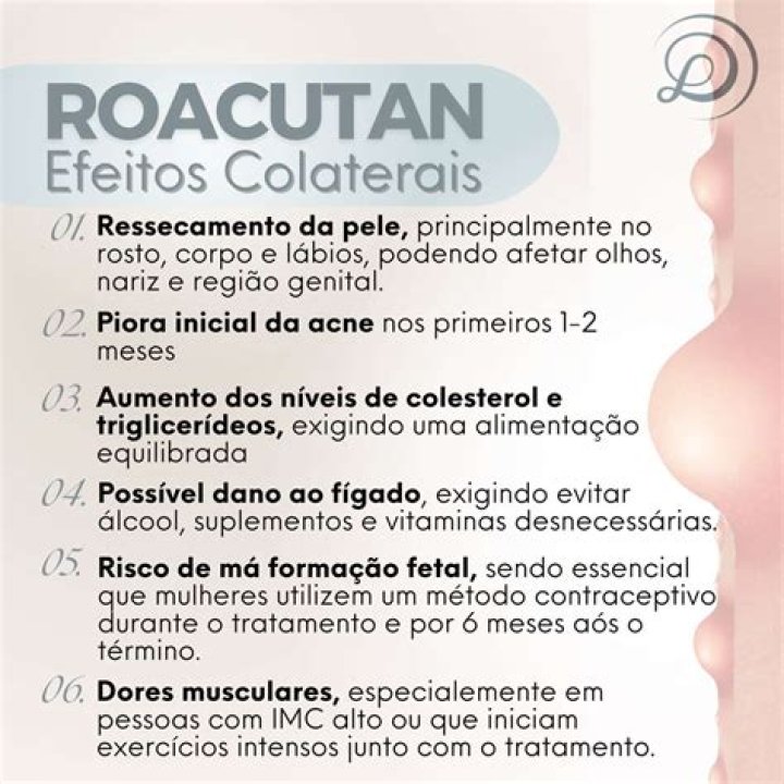 Como conseguir o Roacutan no SUS?