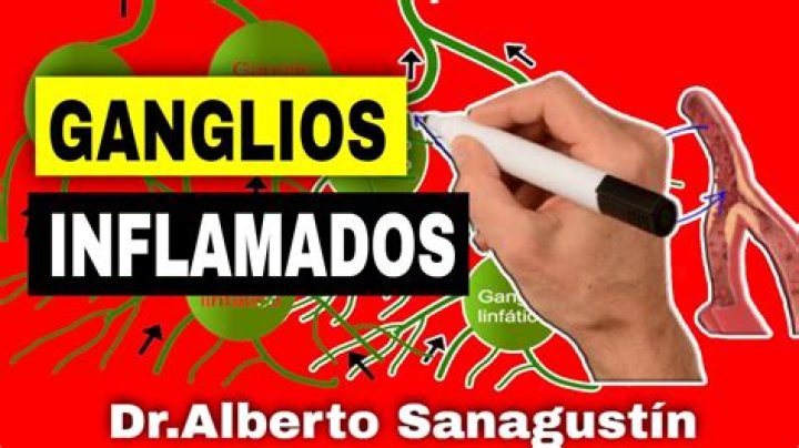 ¿Cómo tratar ganglios inflamados en niños?