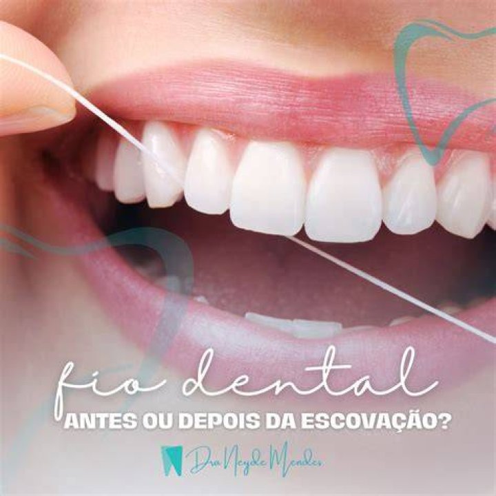 Como usar o fio dental antes ou depois da escovação?