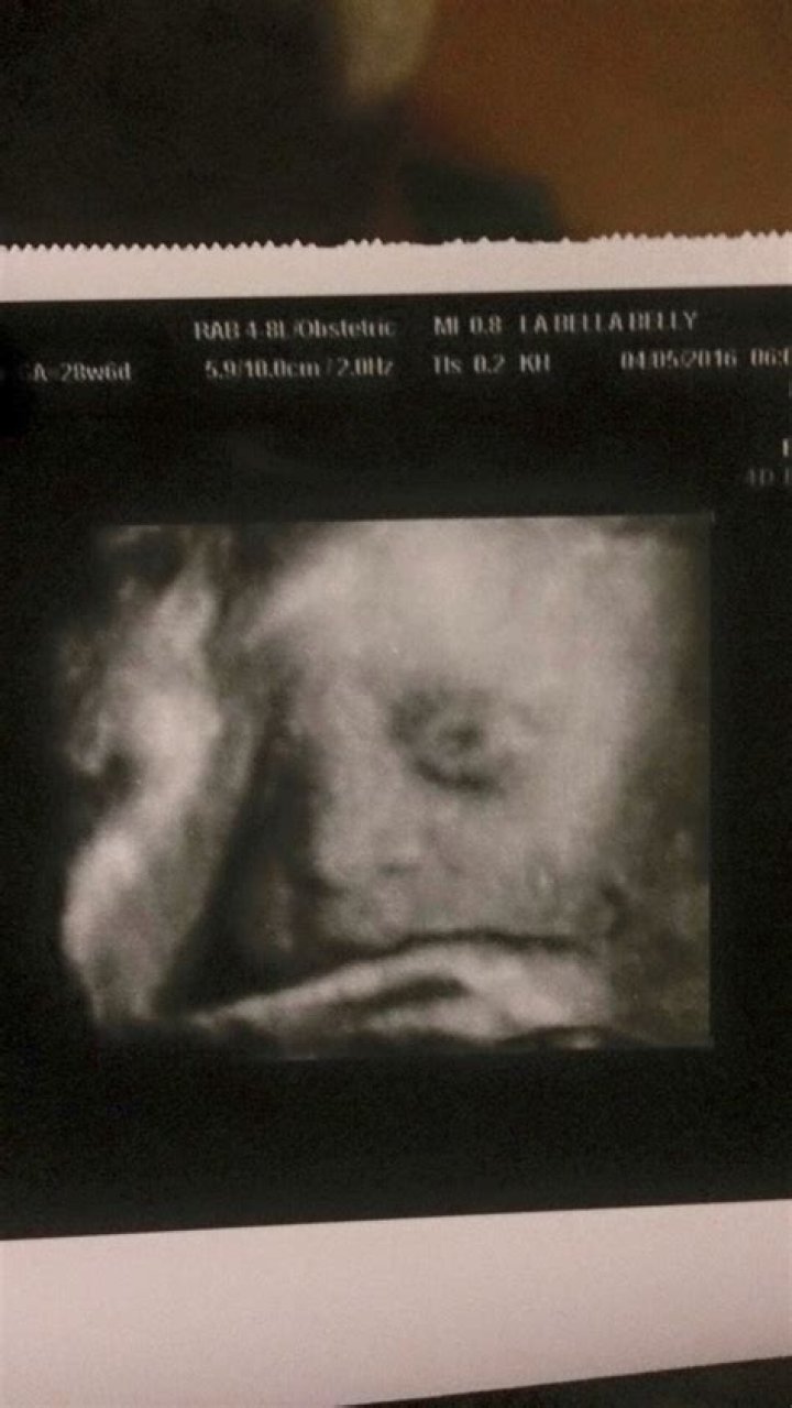 Do baby looks scary in ultrasound?