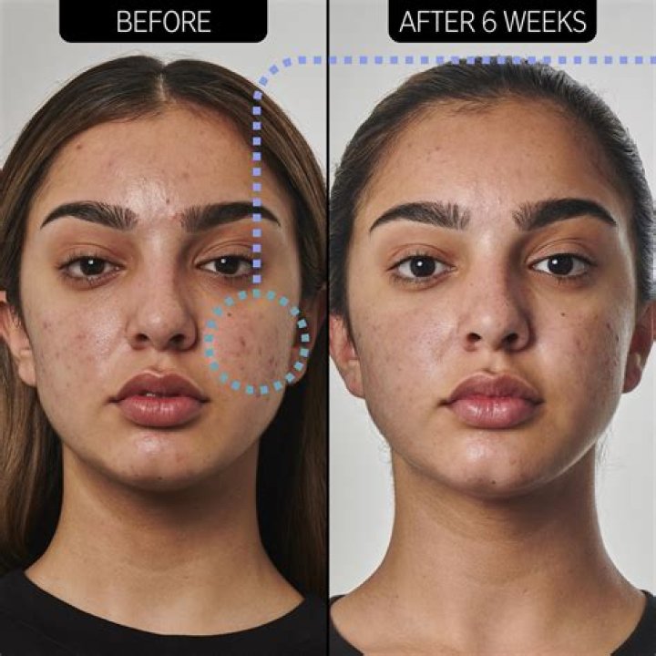 Do I wash my face after using moisturizer?