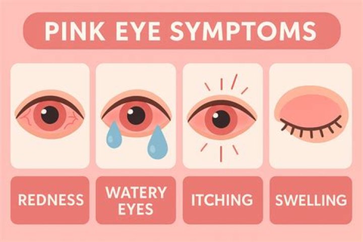 Do pink eyes exist?