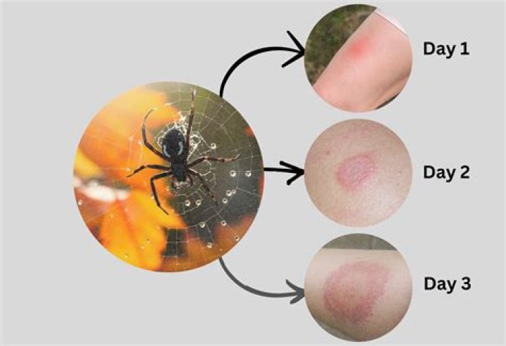 Do the little red spiders bite?