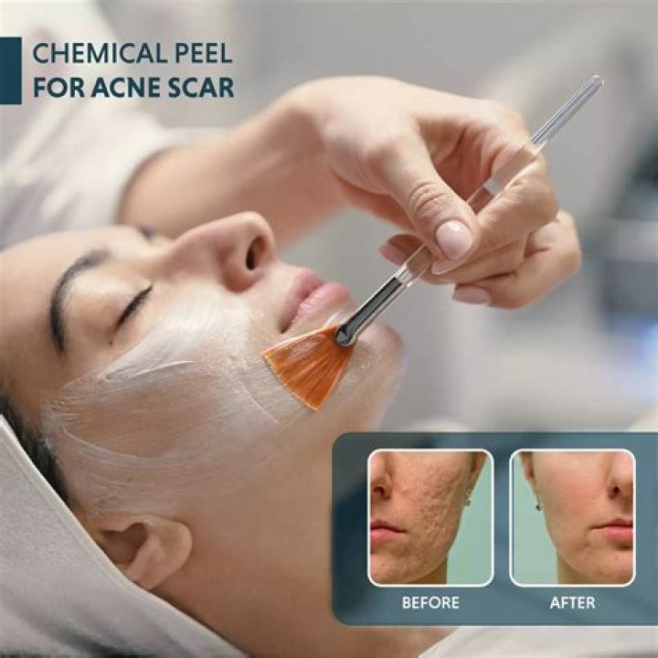 Does Fabior make your skin peel?