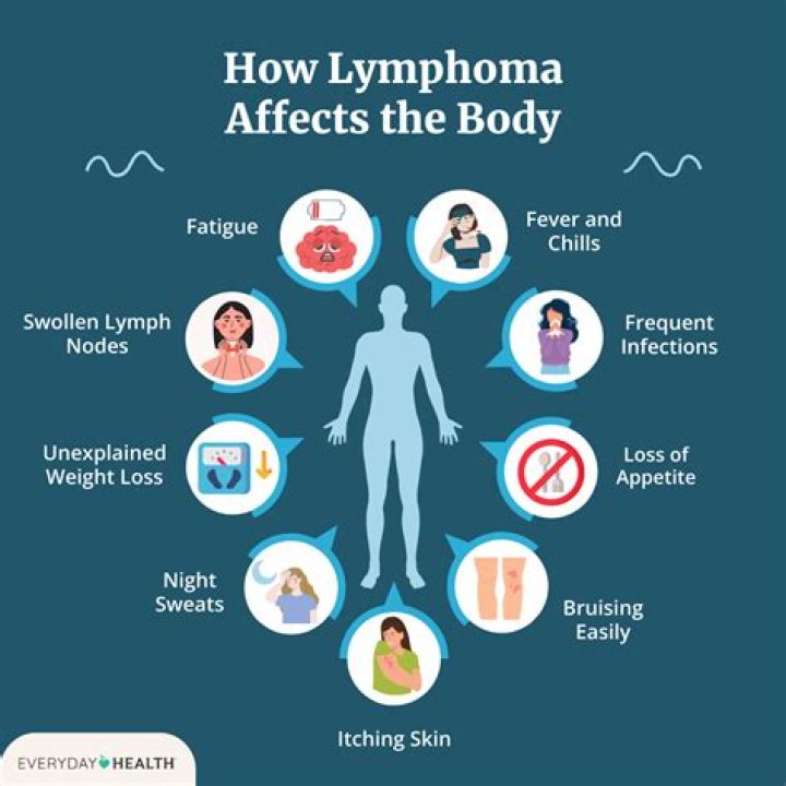 Does lymphoma cause knee pain?