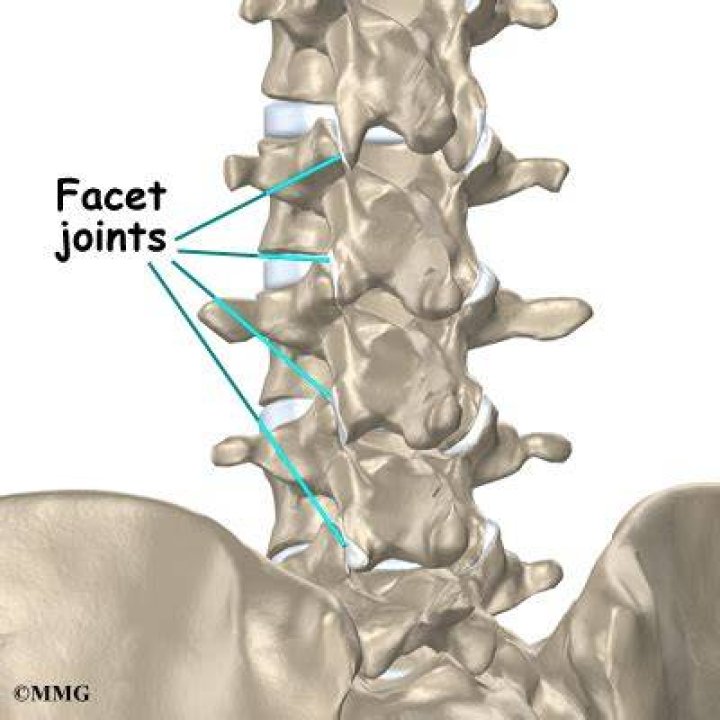 Does s1 have a facet joint?