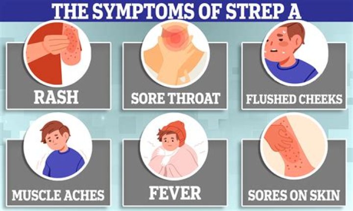 Does Strep G need to be treated?