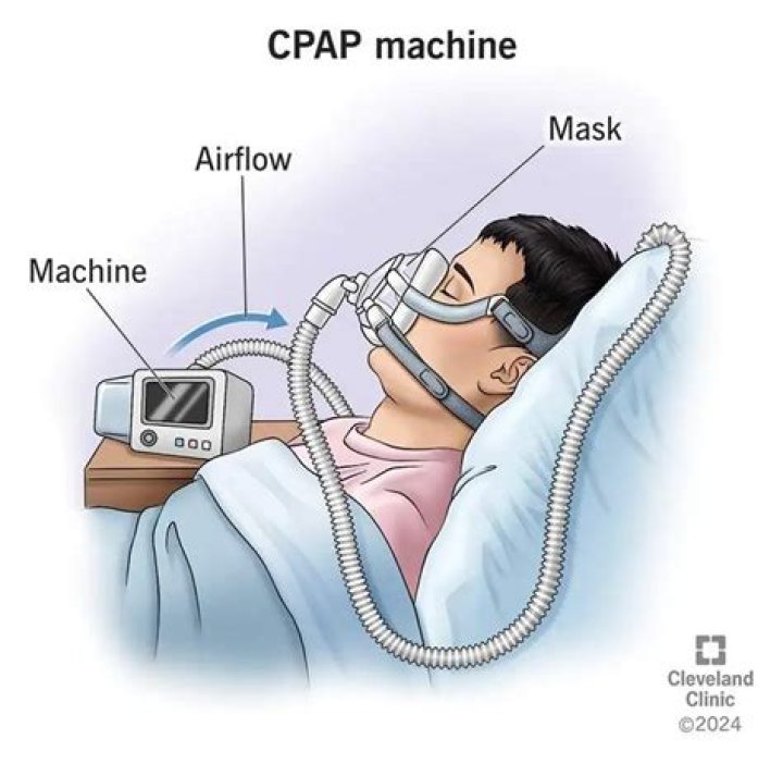 How do I know what CPAP setting to use?
