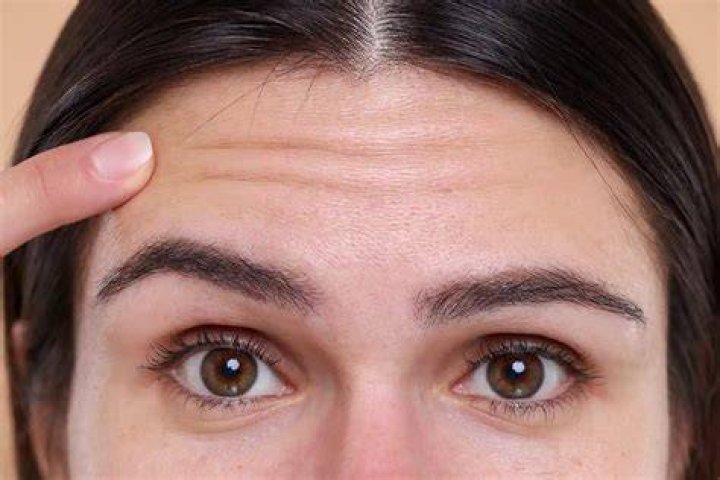 How do I prevent scarring on my forehead?