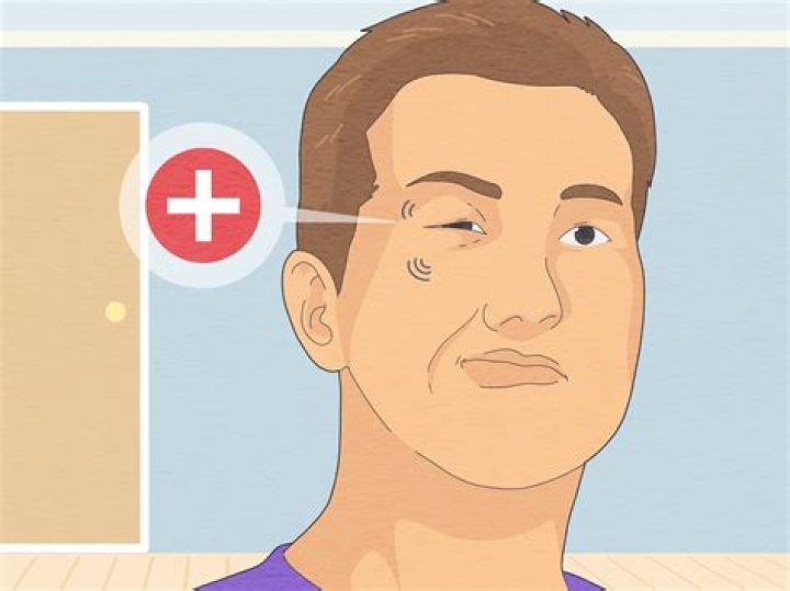 How do I stop my eye from throbbing and hurting?