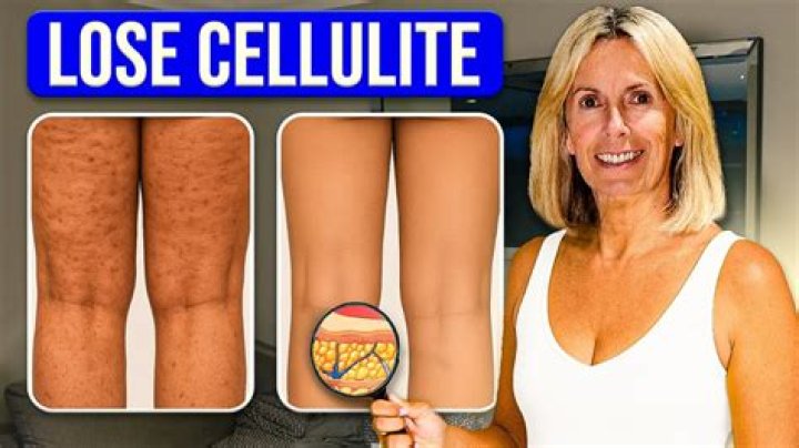 How do you cover cellulite on your legs with makeup?