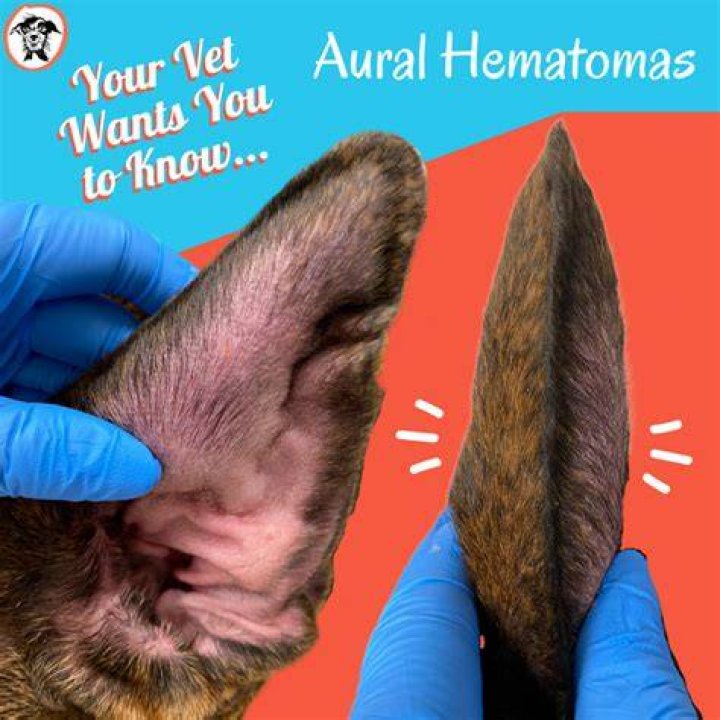 How do you know if you have a hematoma after a vasectomy?