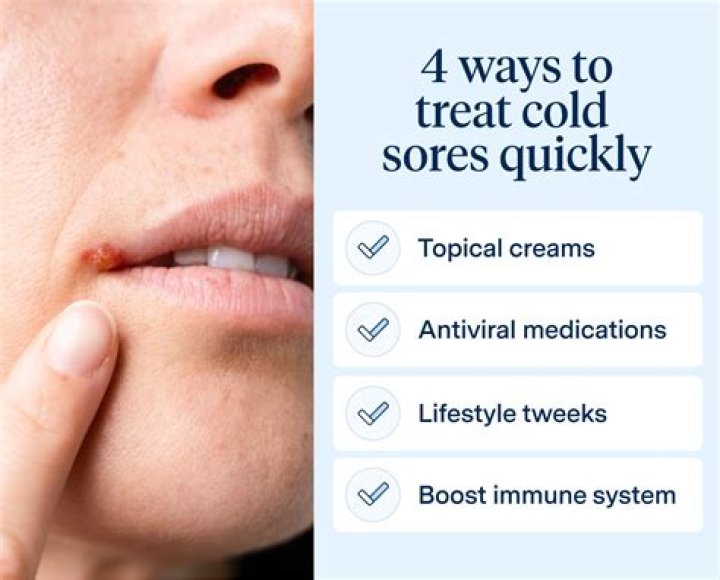 How do you treat a burst vein?