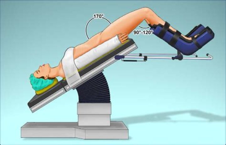 How is a patient positioned in the Fowler's position?