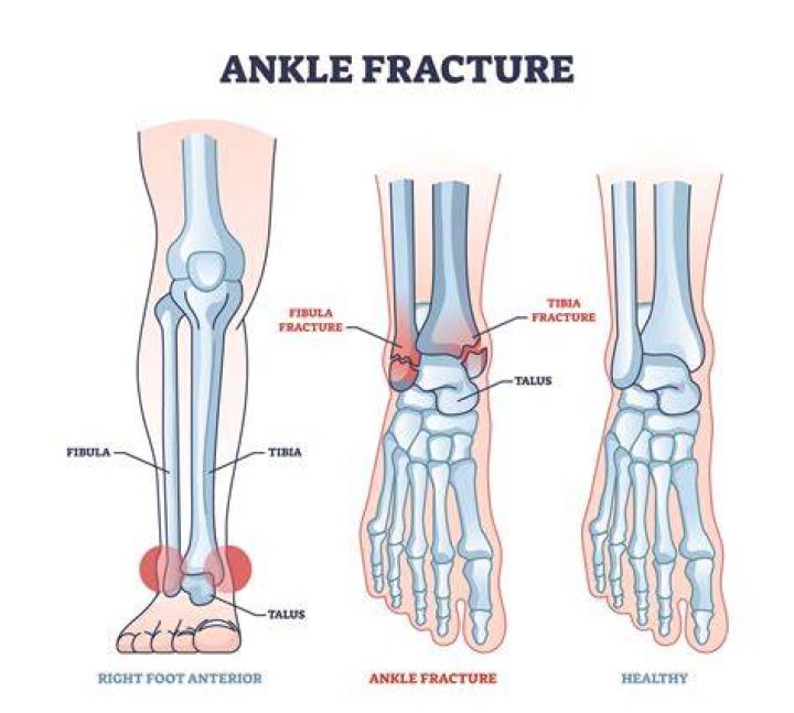 How long is fractured but whole?