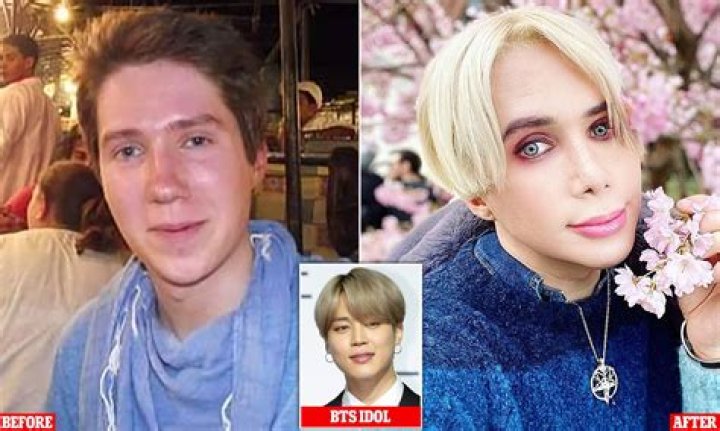 How many surgeries did Oli London have?
