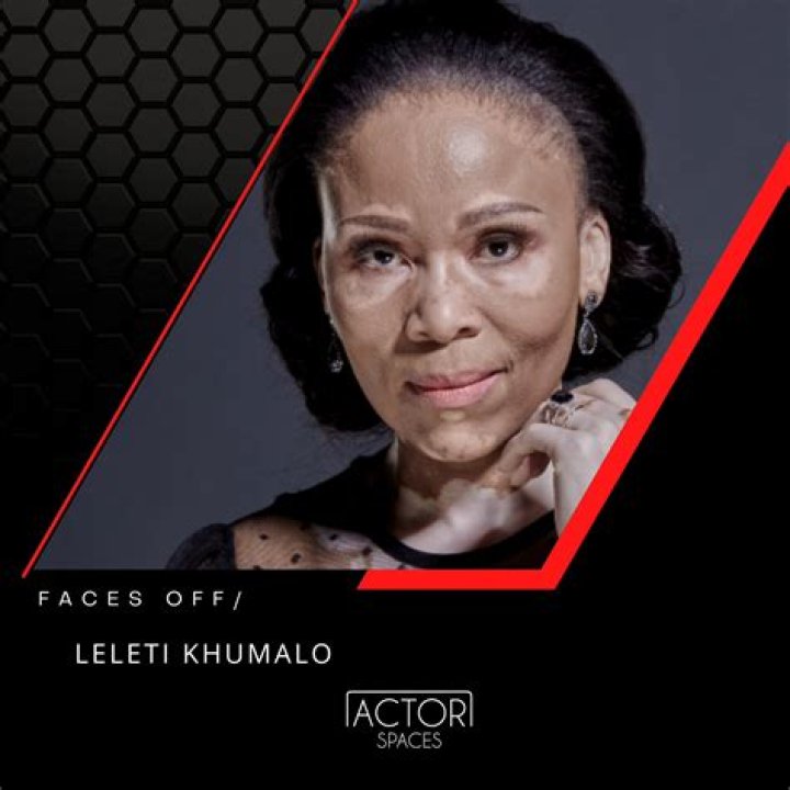 How old is Khumalo?