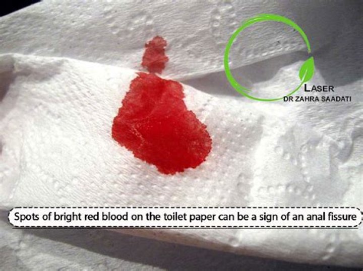 Is dried blood on paper dangerous?