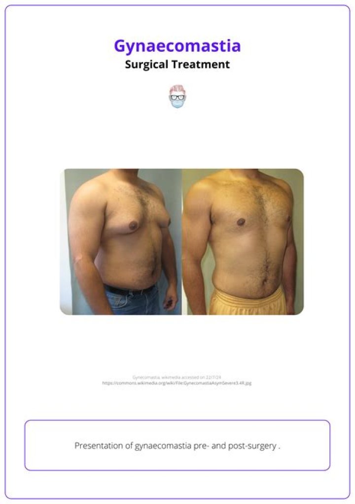 Is gynecomastia supposed to hurt?