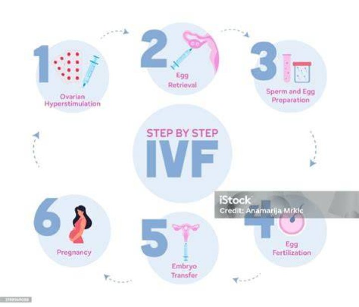 Is IVF free in Ireland?