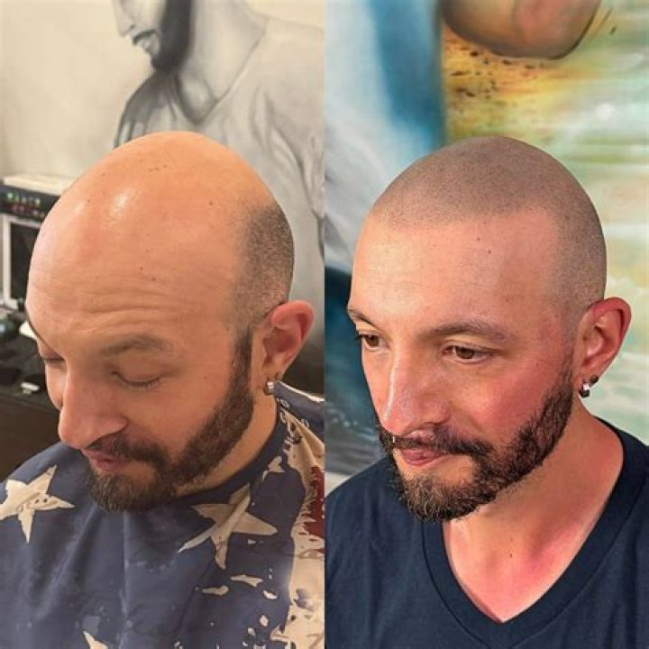 Is there a non damaging perm?