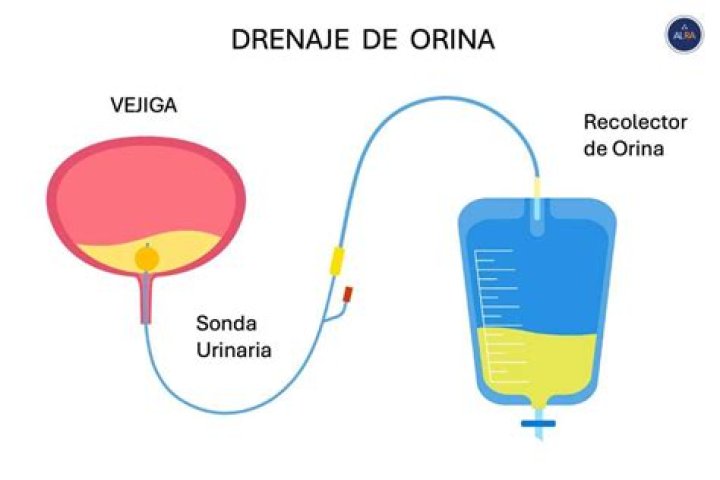 ¿Por que después de orinar me sigue saliendo orina?