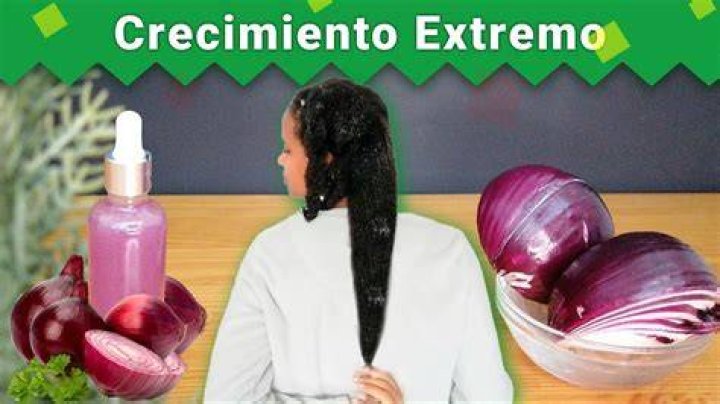 ¿Qué cebolla se utiliza para hacer crecer el cabello?
