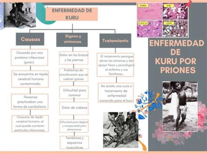 ¿Qué es la enfermedad de Kuru?