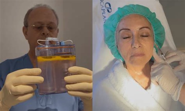 ¿Qué es la ms en medicina?