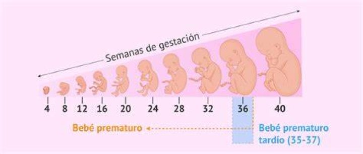 ¿Qué pasa si mi bb nace a las 36 semanas?