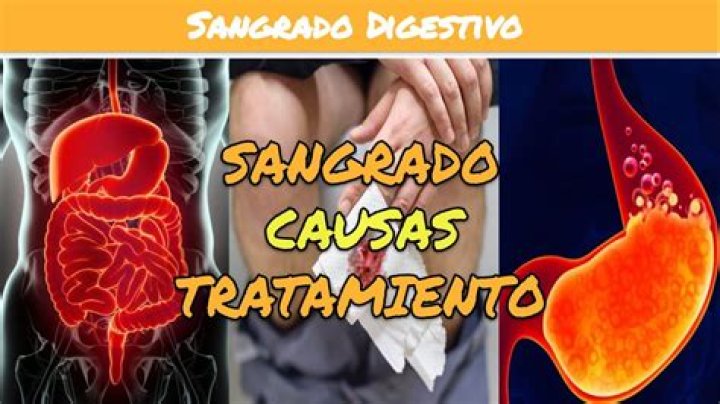 ¿Qué significa no hareis rasguños en vuestro cuerpo por un muerto?