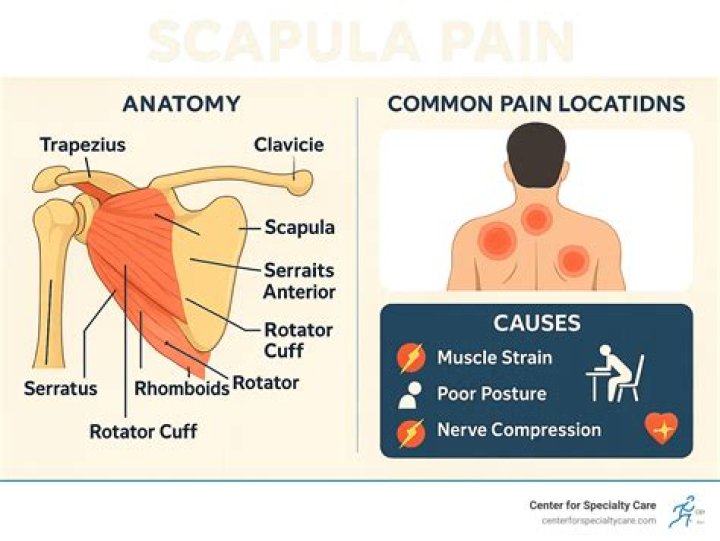 Should you retract your scapula when Deadlifting?
