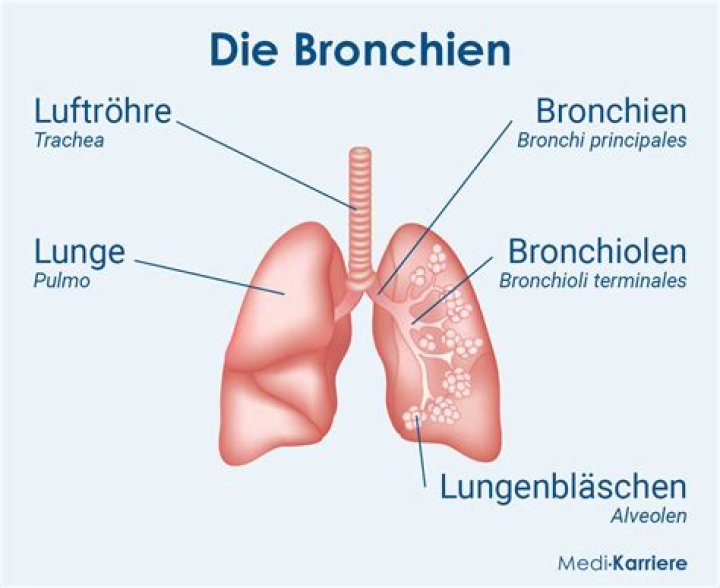 Was passiert wenn man Bronchitis nicht behandelt?
