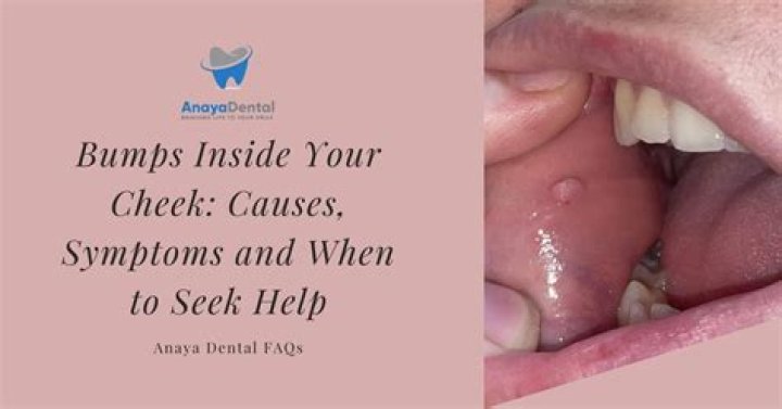 What causes bumps on the inside of your lip?
