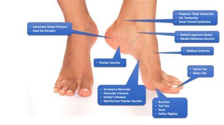 What causes sharp pain in the tips of your toes?