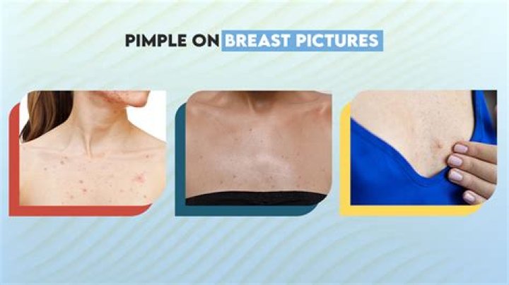 What does breast bottoming out look like?
