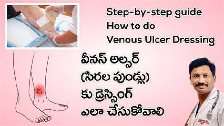 What dressing to use on a venous ulcer?