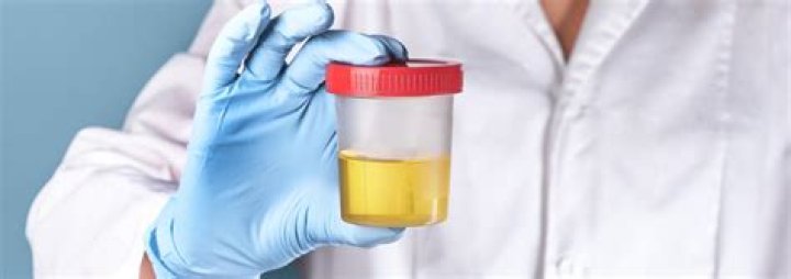 What is a 7-panel urine test?