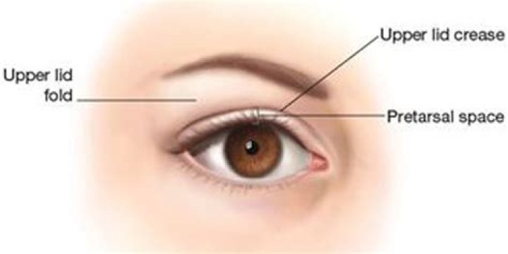 What is the crease of your eyelid called?